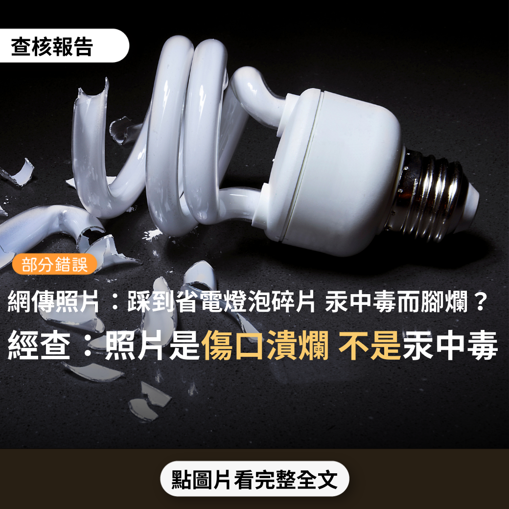 【部分錯誤】網傳「省電燈泡的危險性…這隻腳的主人，換燈泡時摔破了燈泡…又不慎一腳踩上碎玻璃…因汞中毒，腳上的皮膚肌肉組織無法停止的壞死」？