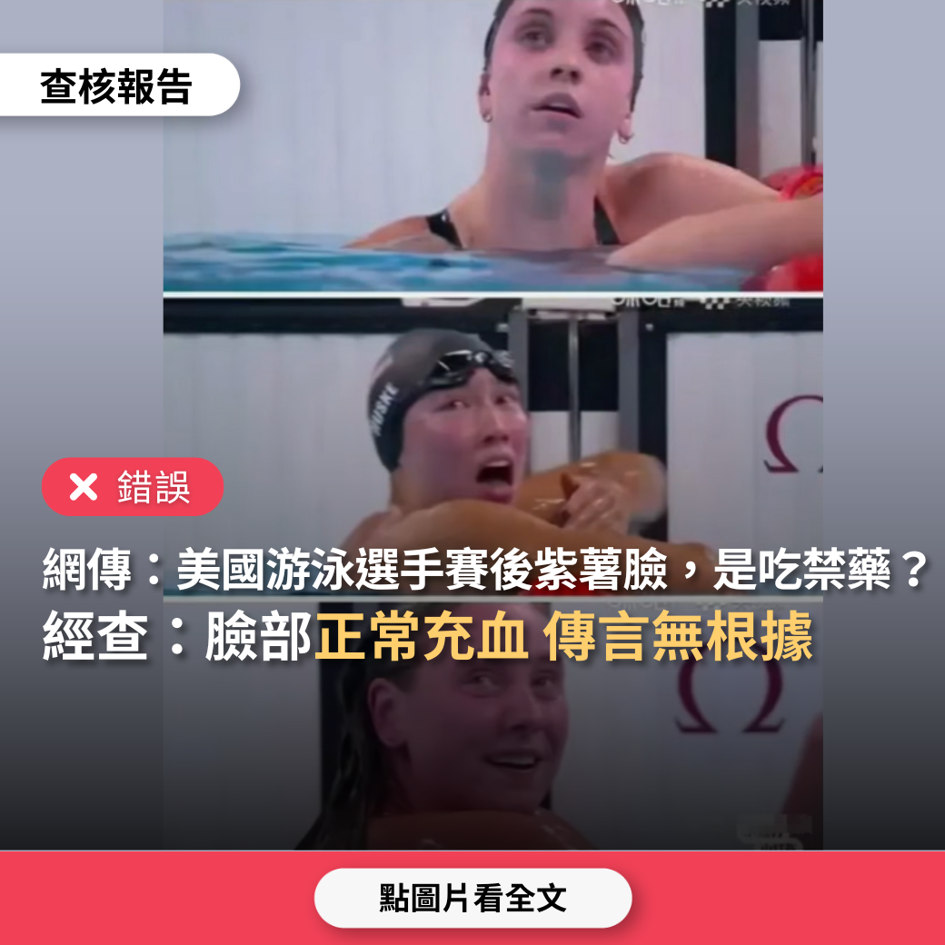 【錯誤】網傳「美國游泳選手比賽完變成紫薯臉，是吃了禁藥」？